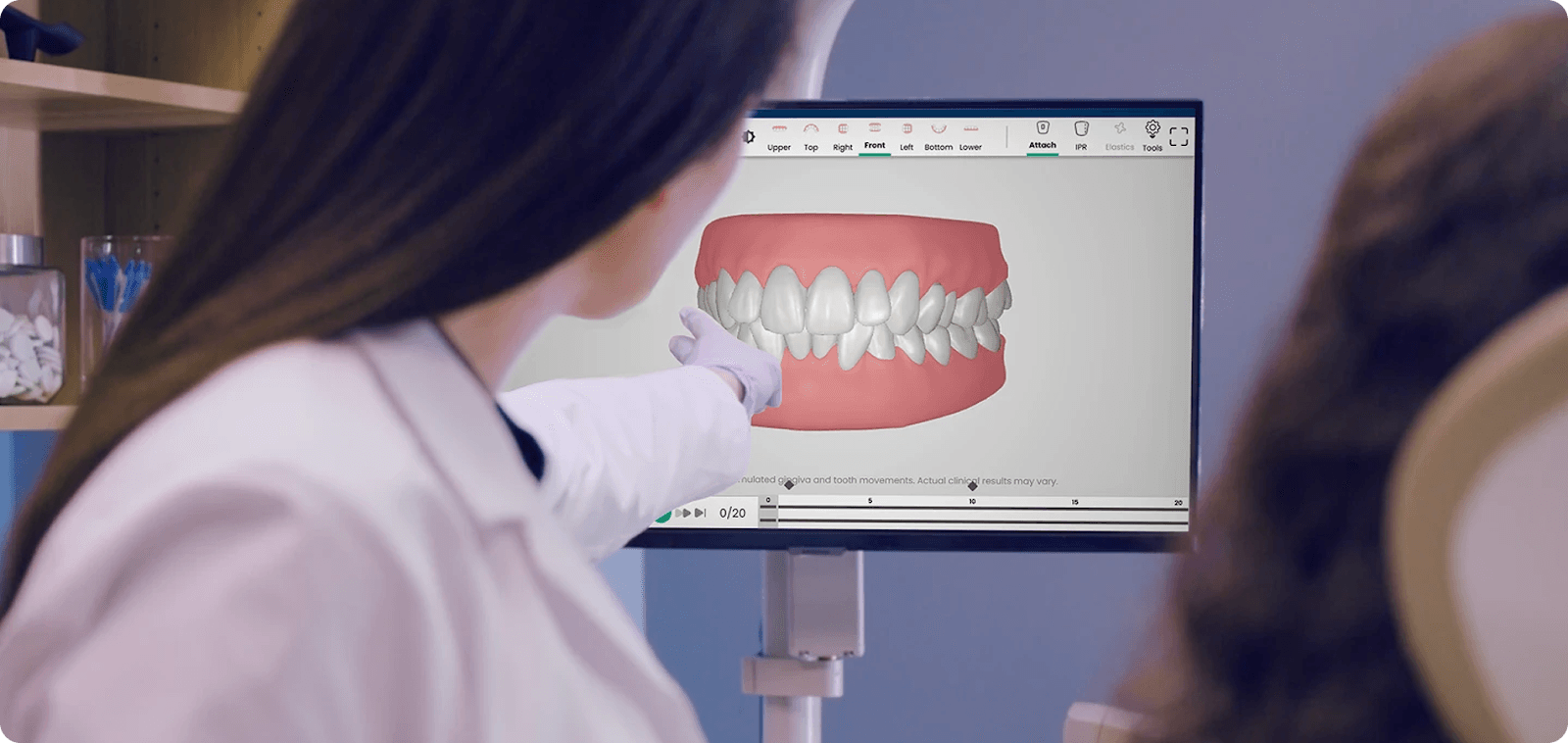 Motto Clear Aligners, photo 3