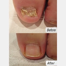 Laser Treatment Specialists, photo 3