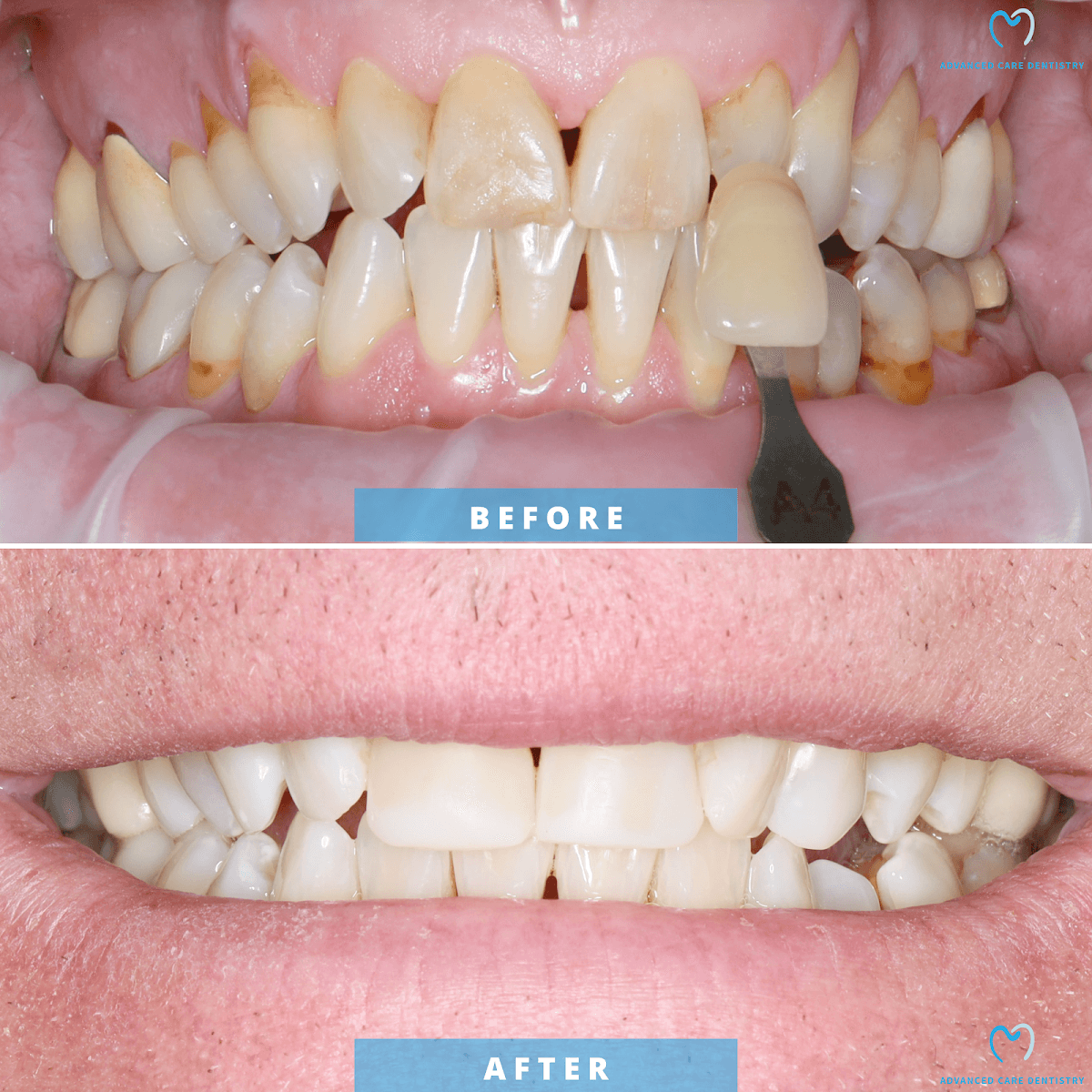 Advanced Care Dentistry, photo 4
