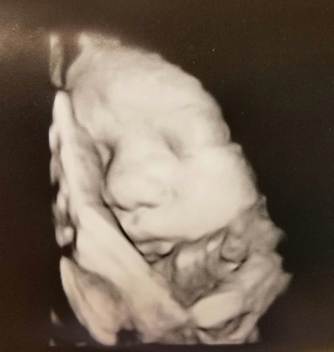 Dr. Samuel B. Wolf, DO at Emerald Coast OB/GYN