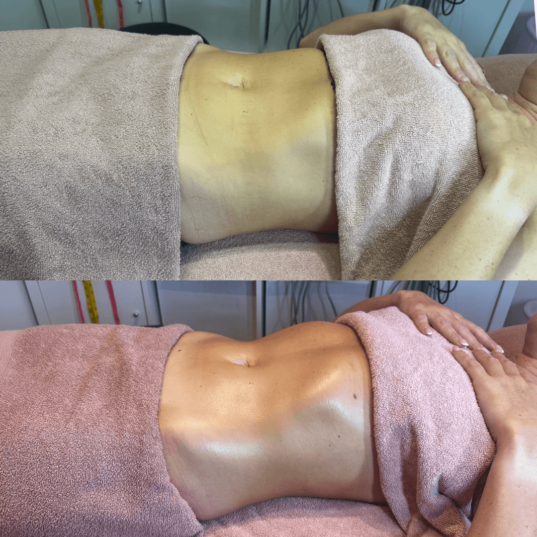 Body Sculpting Herts