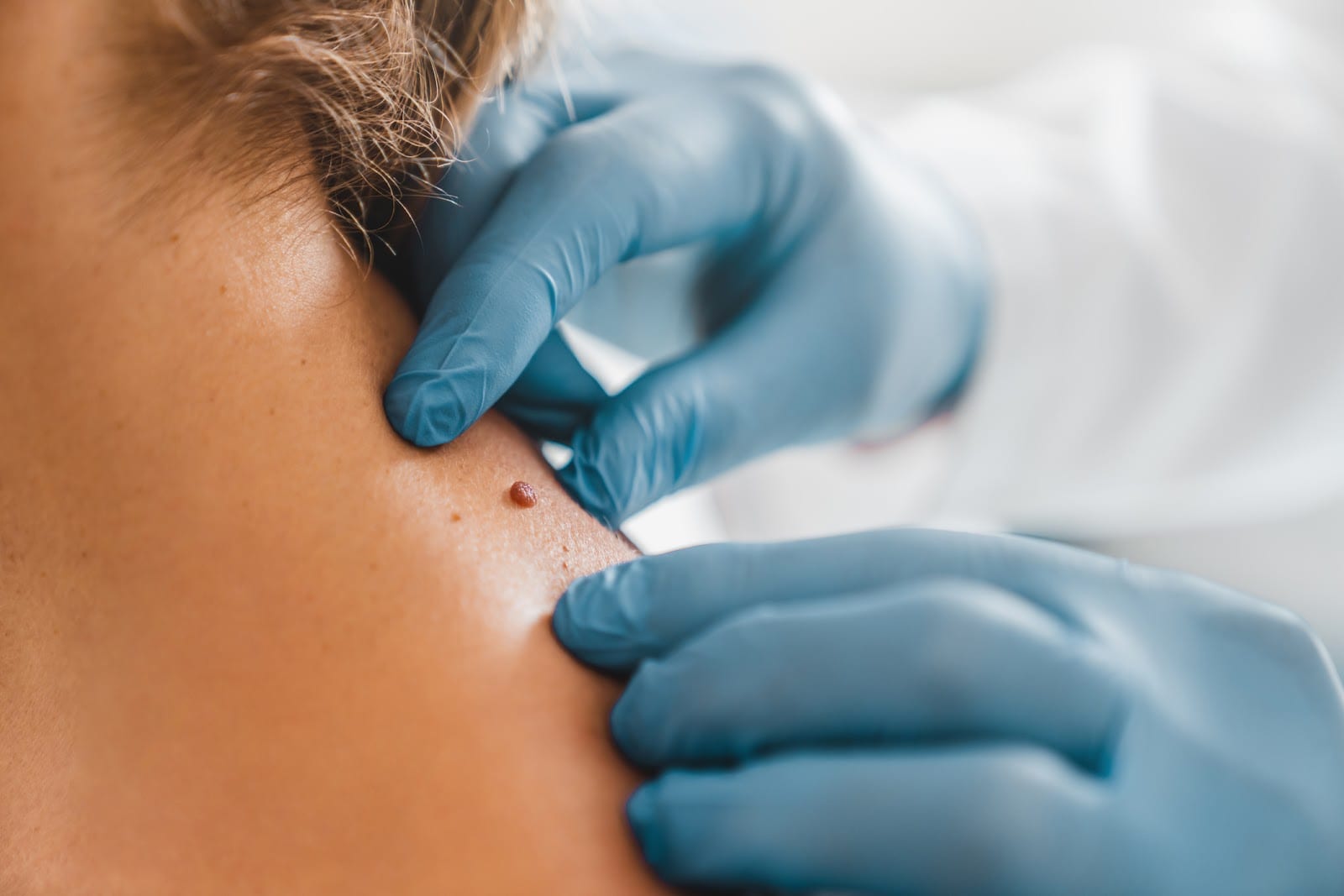 Academic Alliance in Dermatology - Swann