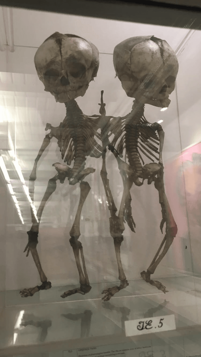 Barts Pathology Museum