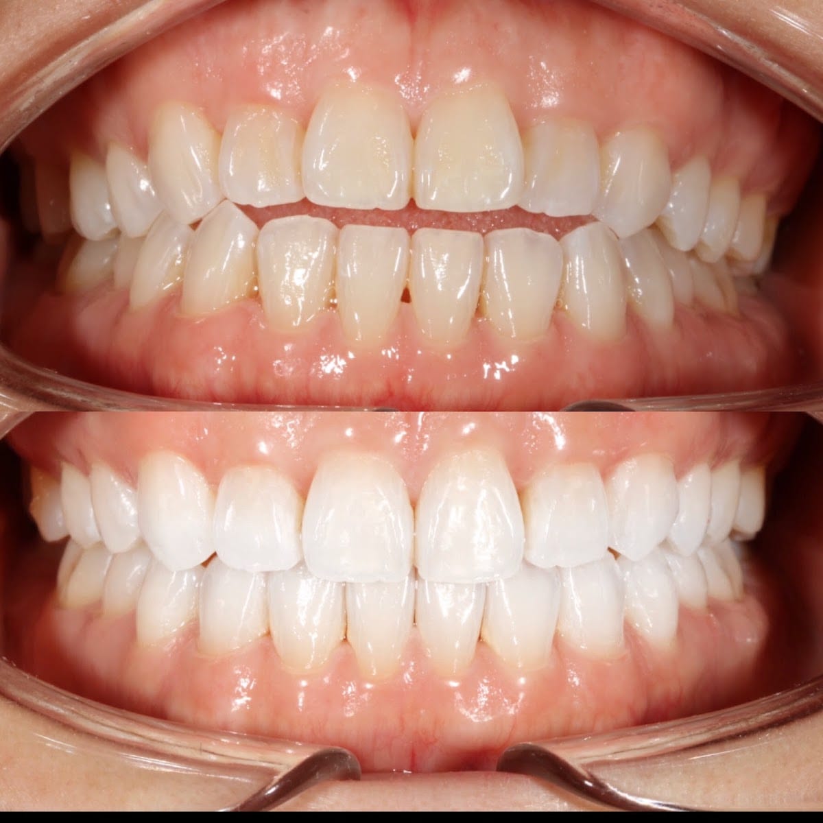 Dentistry of San Francisco - General & Cosmetic Dentist Dr. Joseph, DDS