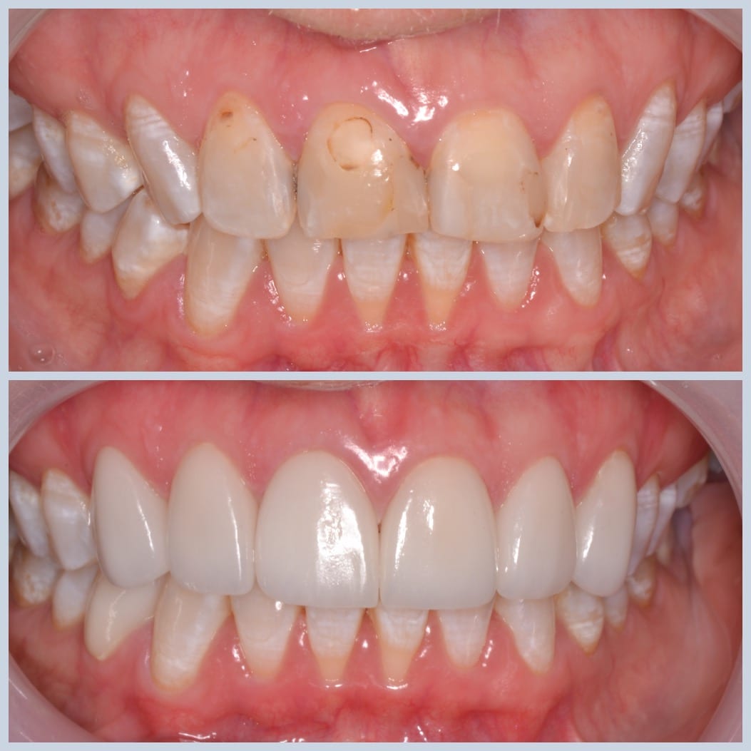 Smiles for Life Dental Care, photo 2