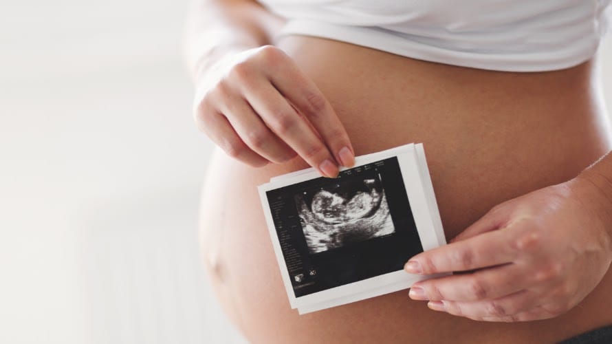 PAMS Pregnancy Ultrasound Centre, photo 2
