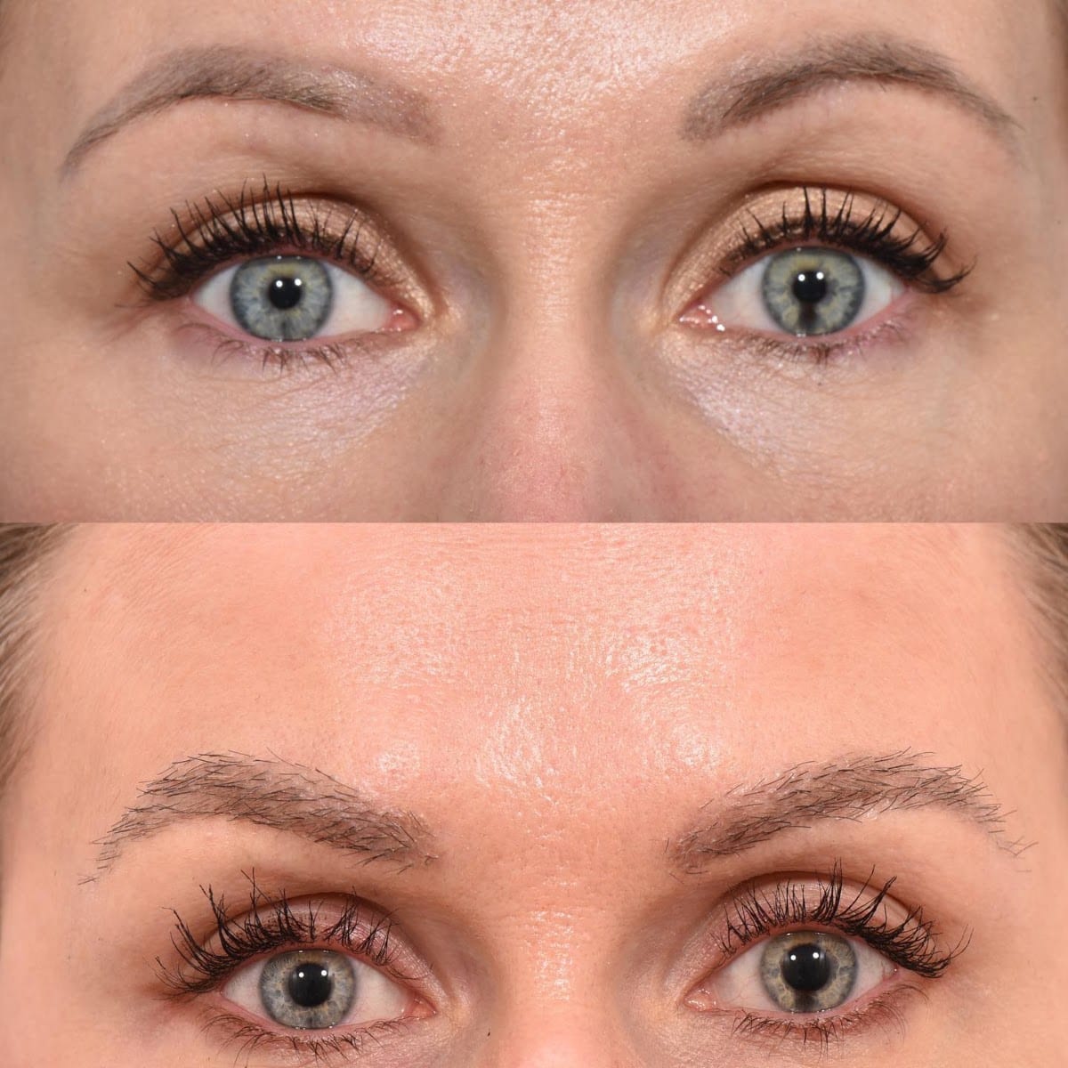 Quatela Center for Hair Restoration
