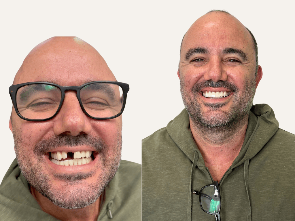 Dentalvana
