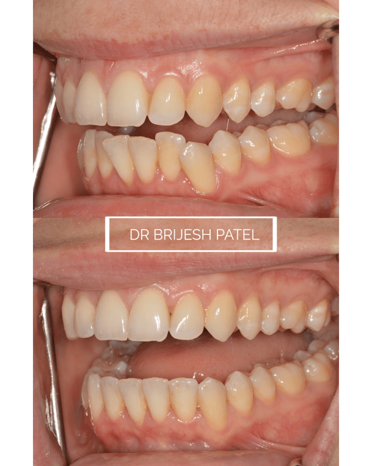 Dr Brijesh Patel Dentistry, photo 3