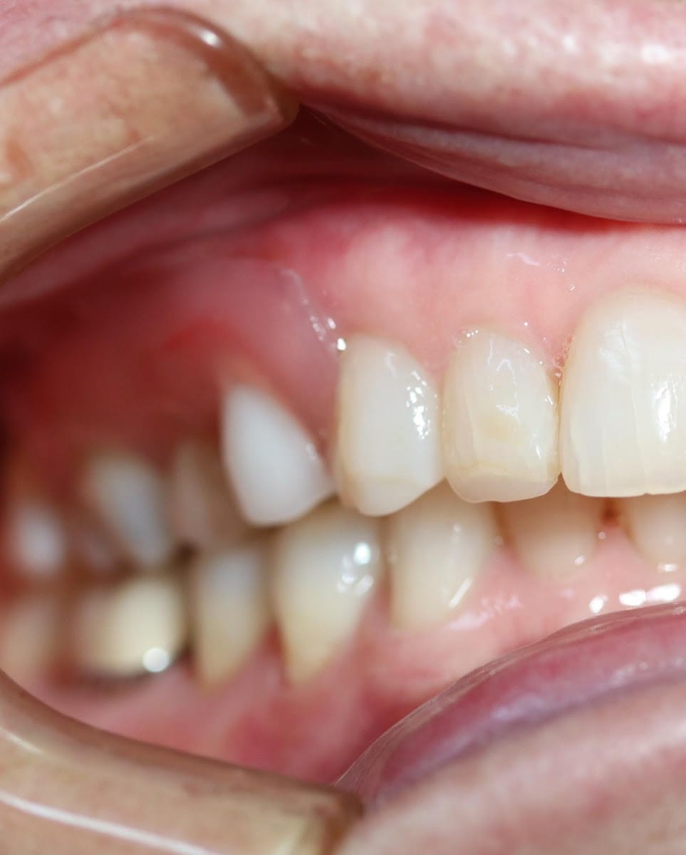 Cane to Coast Dentures Mackay, photo 3