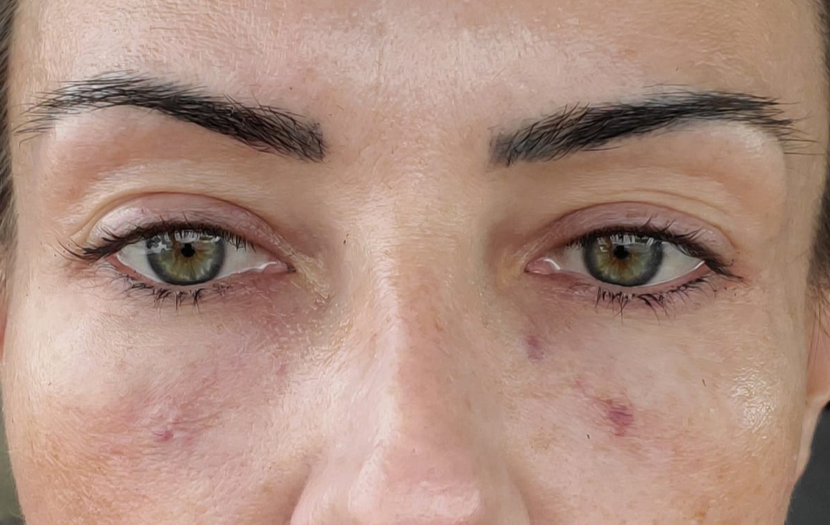 Lumier Medical Spa, photo 3