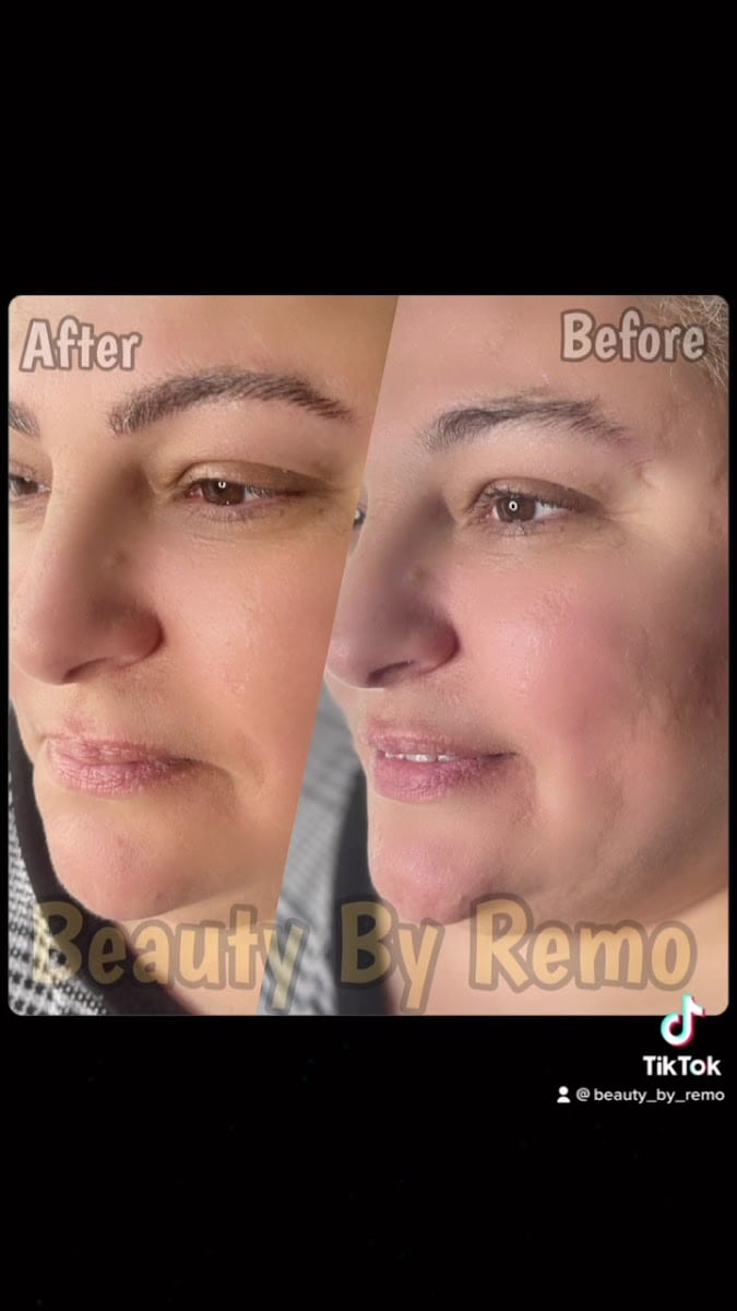 Beauty By Remo, photo 4