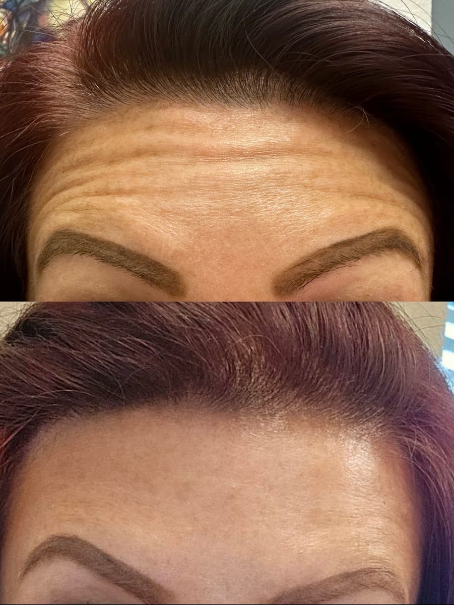Texas Needle Queen • Botox & Lip Filler Clinic | Round Rock, TX, photo 2
