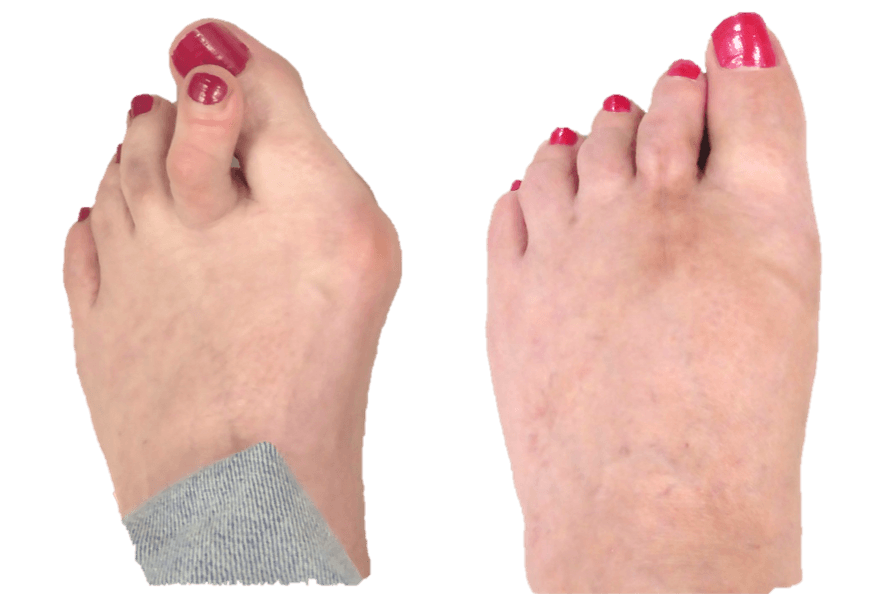 Mr David Gordon - Consultant Orthopaedic Foot and Ankle Surgeon & Keyhole Bunion Specialist
