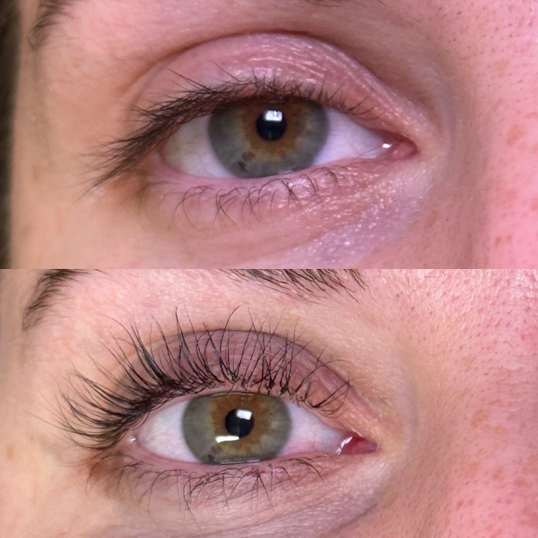 Lash and Company Med Spa - Centennial, photo 3