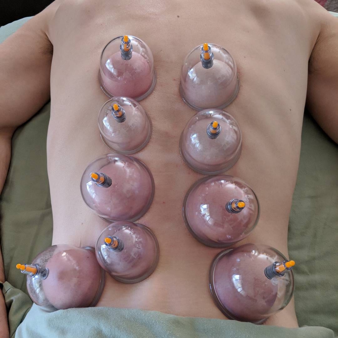 Body Awakenings Az, photo 3