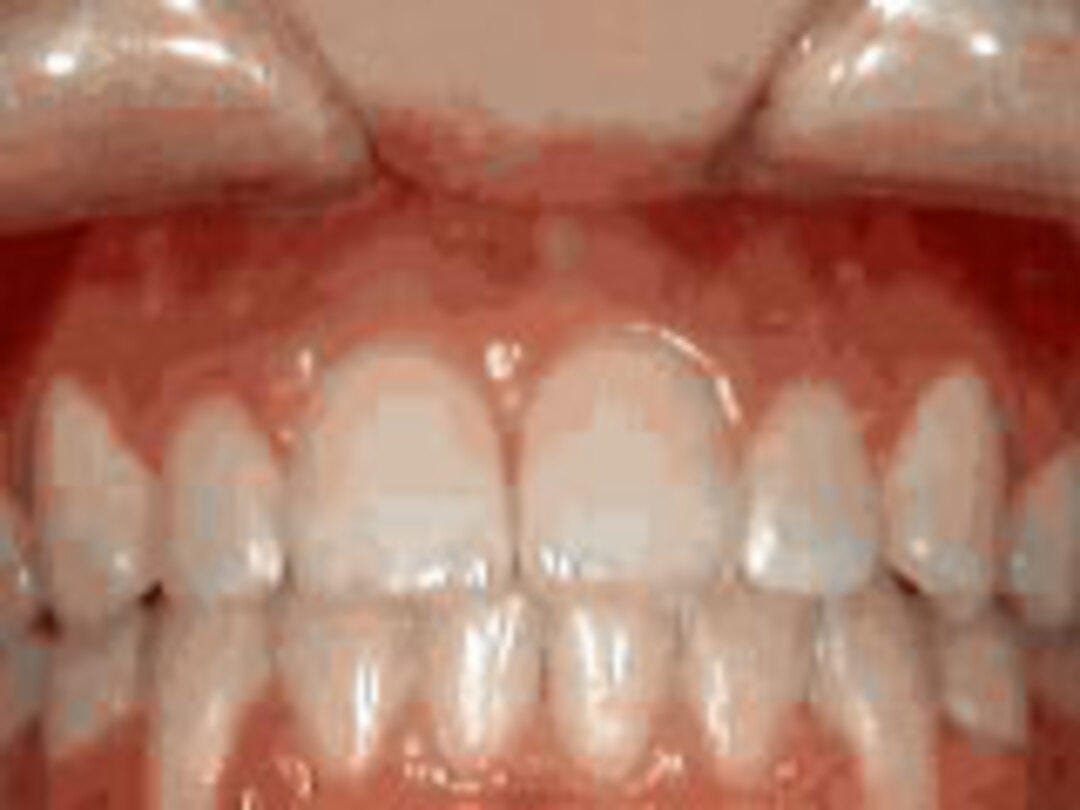 Marsh Orthodontics - William F Marsh DDS, photo 2