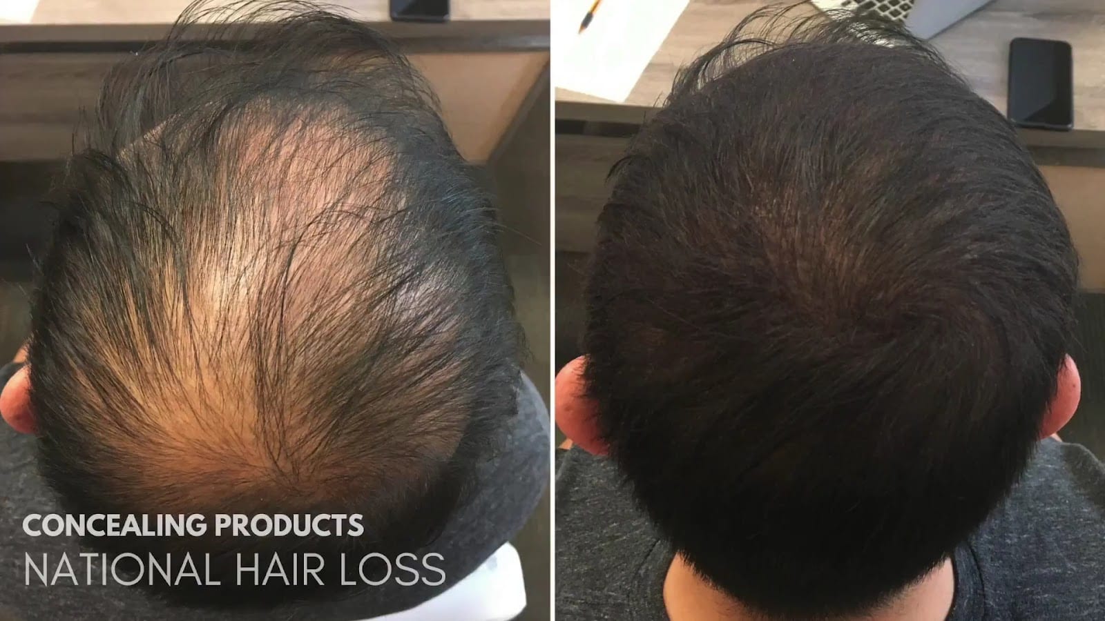 National Hair Loss Medical Aesthetics, photo 3