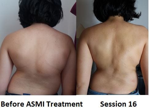 GoodBack Scoliosis Treatment and Back Pain Clinic, photo 3