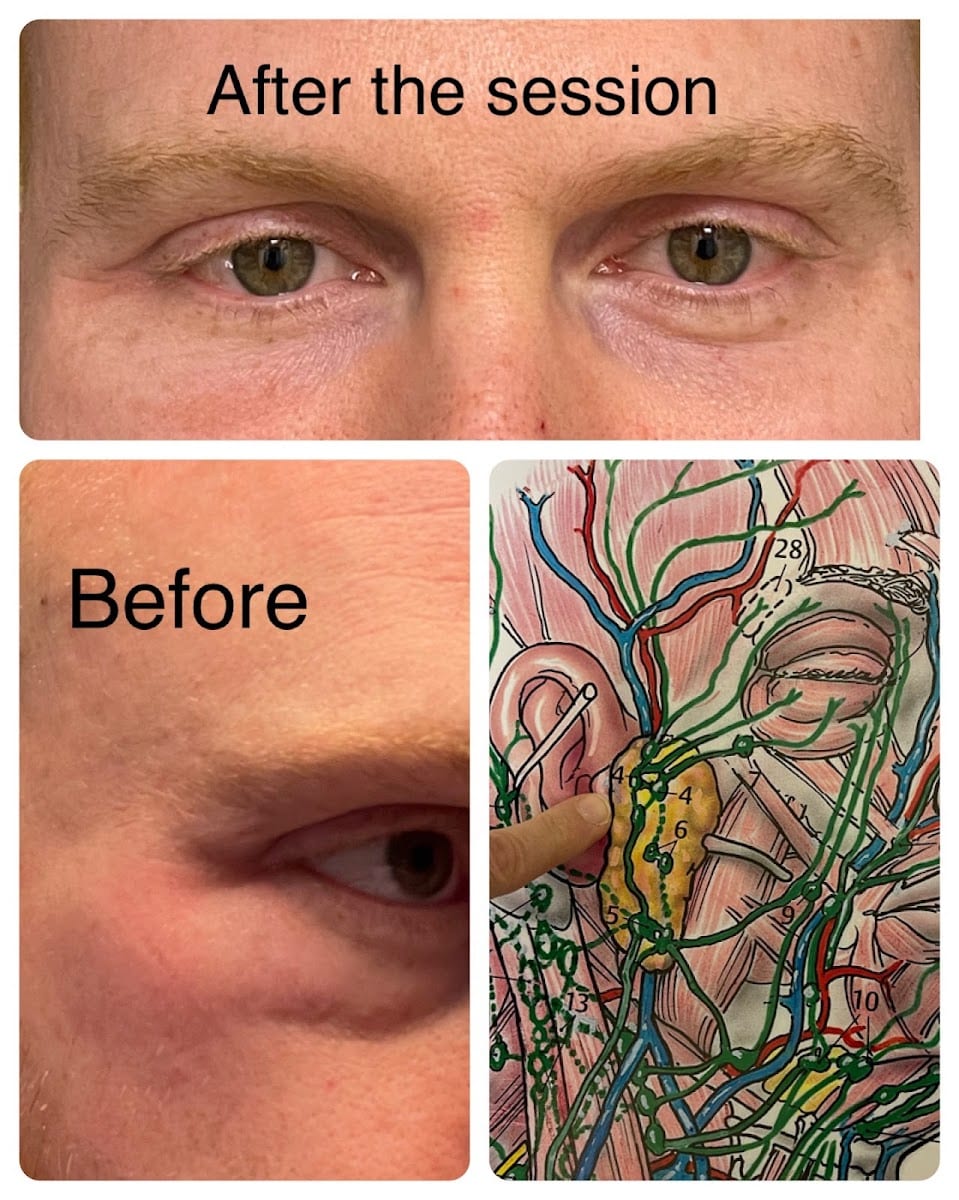 Neuro Lymphatic Bodywork by Mila Vasilyeva, CMT, MLD-C, photo 4