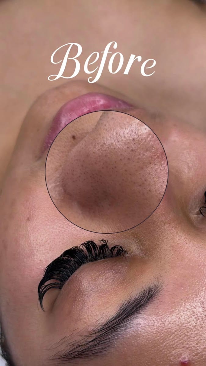 Advanced Esthetics By Bea, photo 3