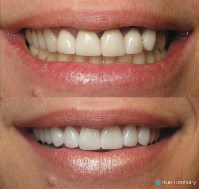 True Dentistry - Summerlin, photo 4
