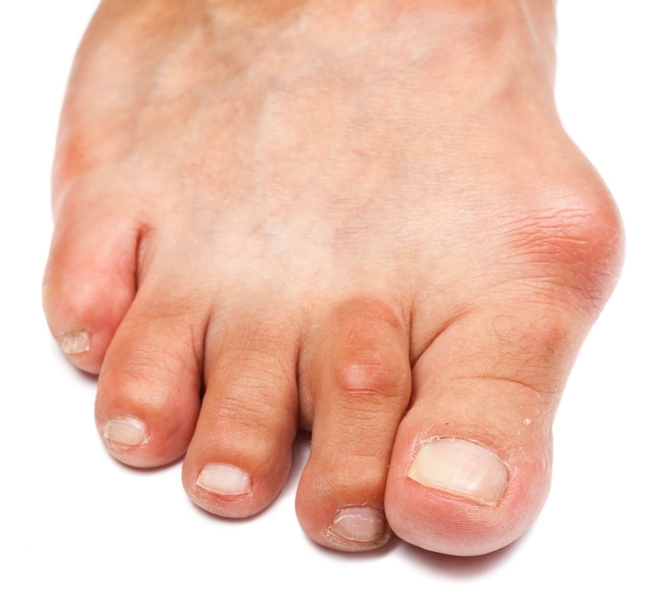 Dr Scott Russell - Podiatry & Orthotics - Sherwood Park, photo 3