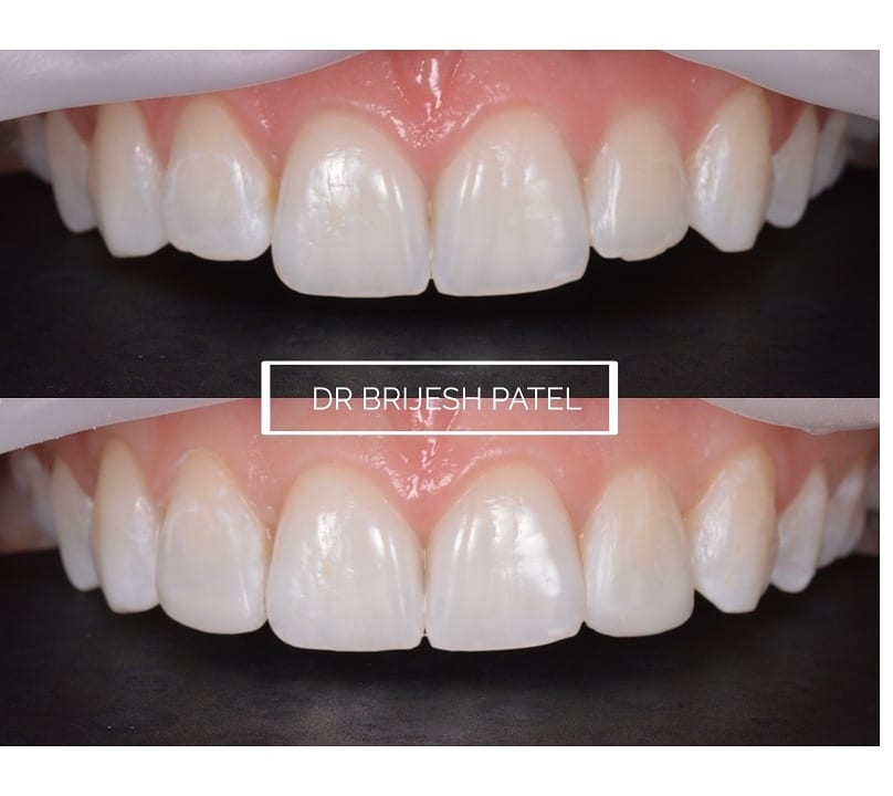 Dr Brijesh Patel Dentistry, photo 2
