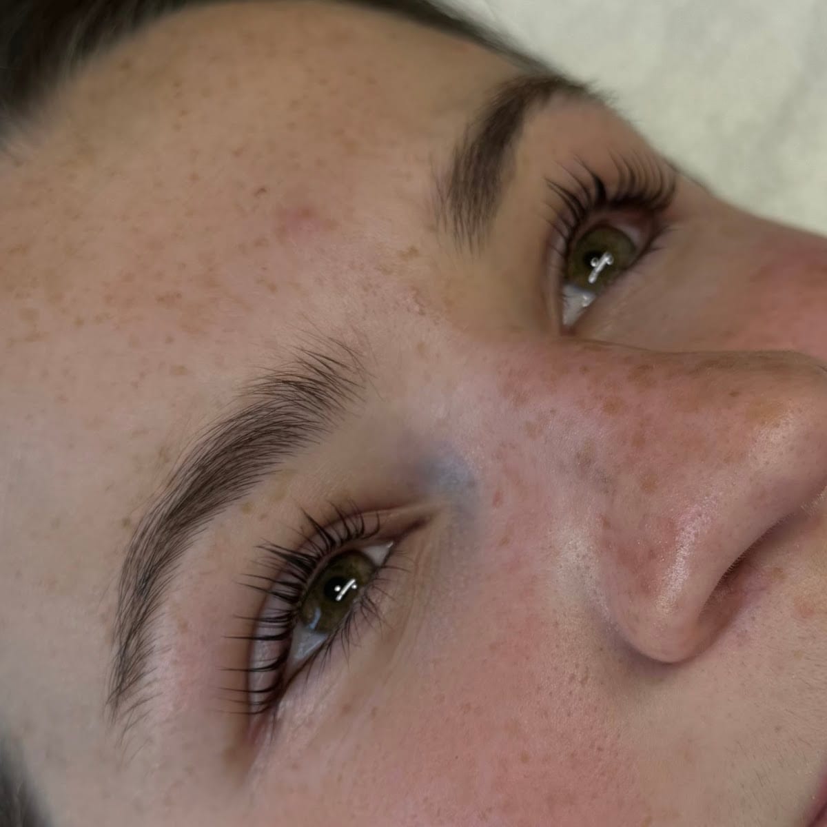 Skinthetics, photo 3