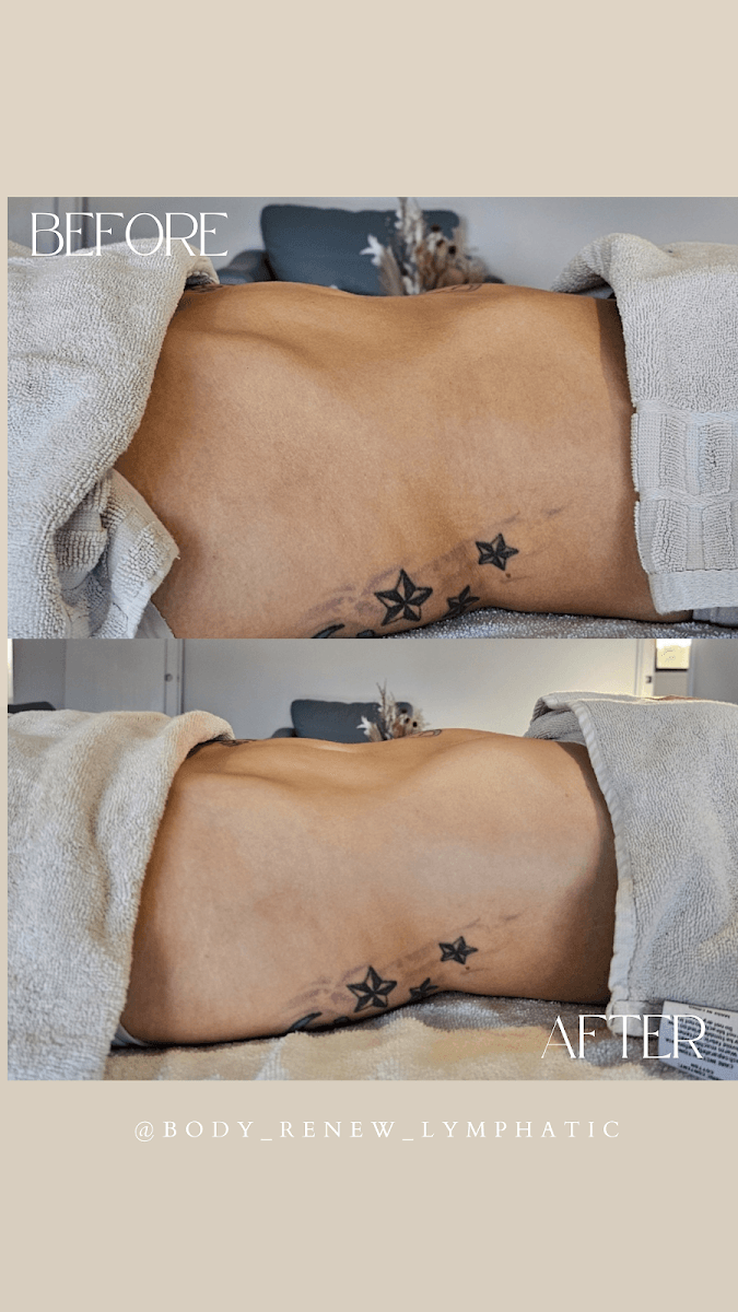 Body Renew Mackay, photo 2