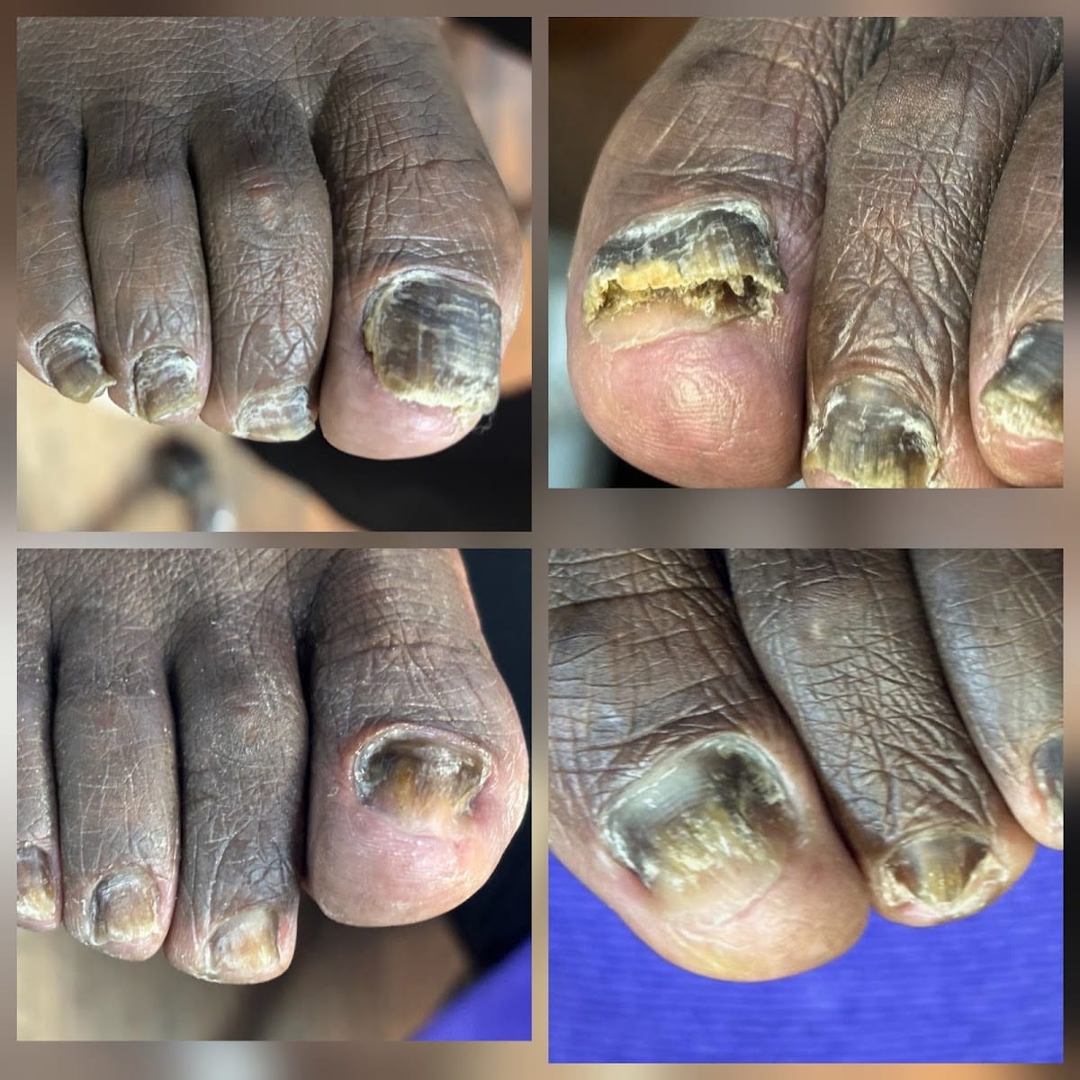 Naturally Nailed Restorative Foot & Nail Care