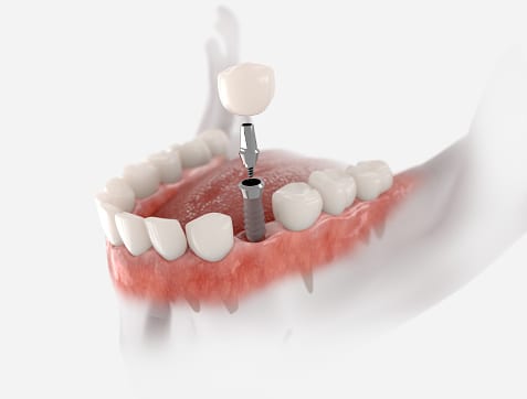 Swift Emergency Dental Solutions