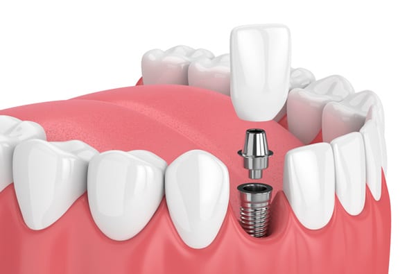 Dental Works, photo 3