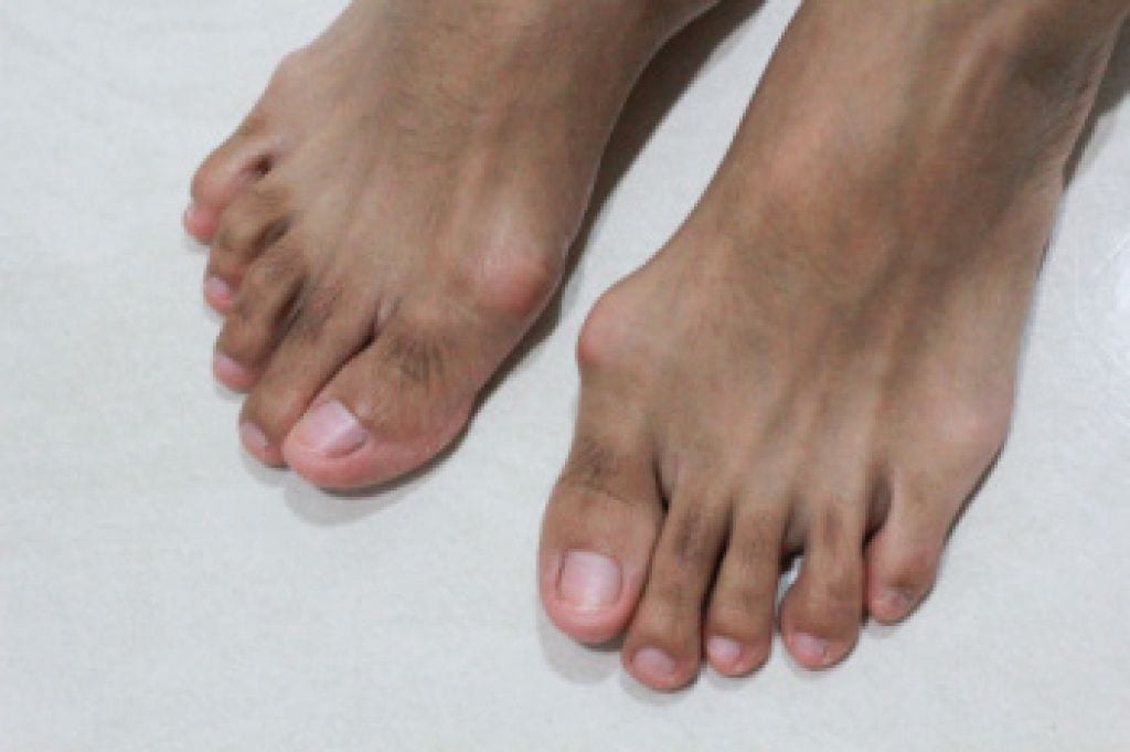 Georgia Foot & Ankle Specialists: Stephan J. LaPointe, DPM, photo 3