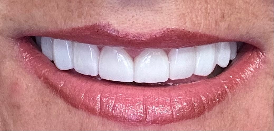 West Villages Dental Care