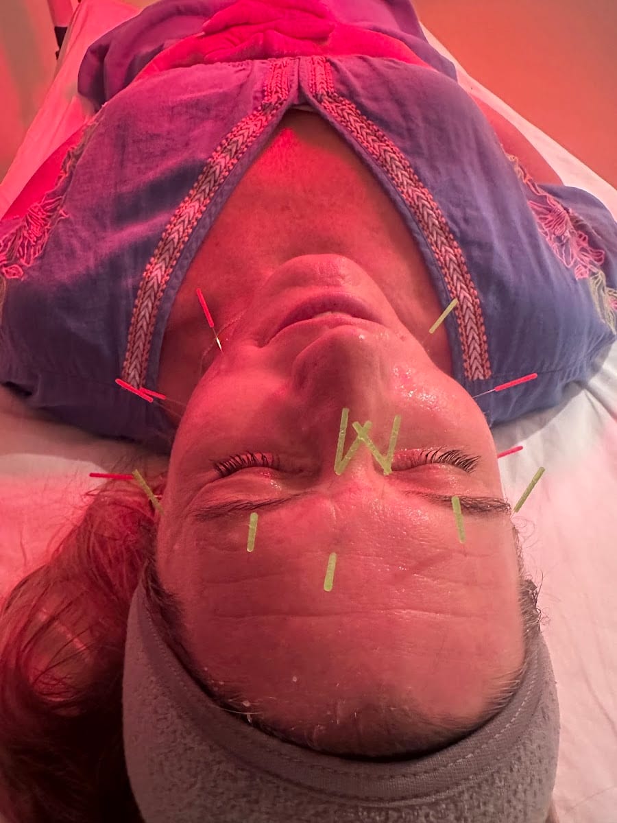 Maria Villella Acupuncture