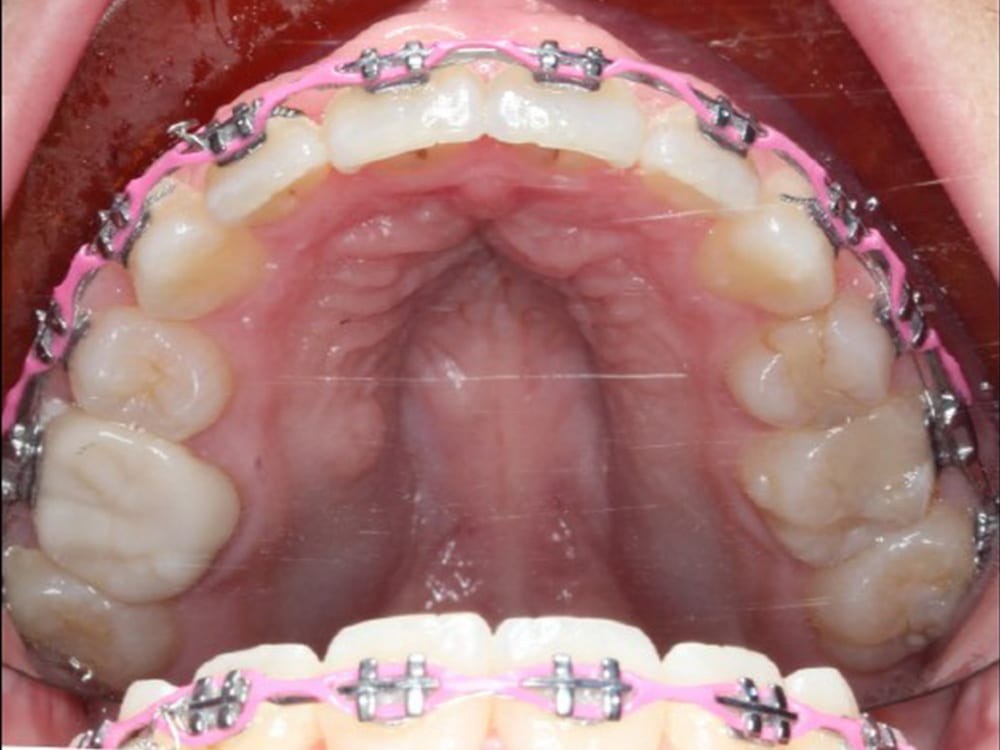 Normandy Lake Dentistry - Orange Park