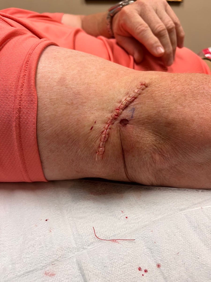 Cary Dunn, MD, FAAD, FACMS, photo 3
