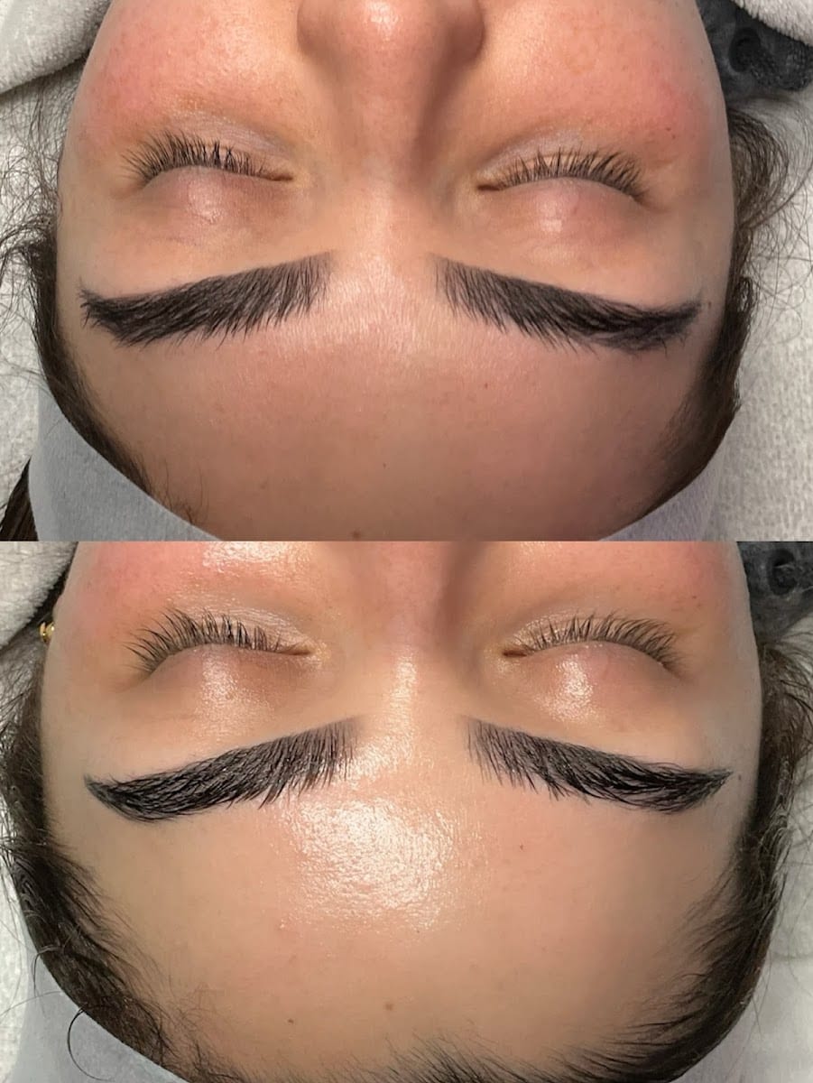 LunaLex Esthetics, photo 3