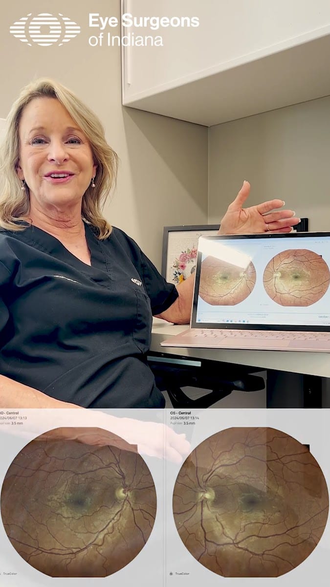 Eye Surgeons of Indiana - Anderson, photo 3