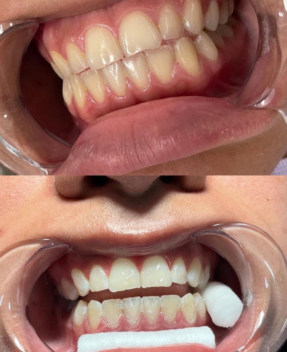 Hollywood Smiles409 Cosmetic Teeth Whitening, photo 2