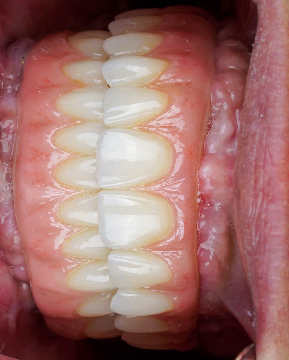 Eleve Dental Cosmetic & Implant Center, photo 4
