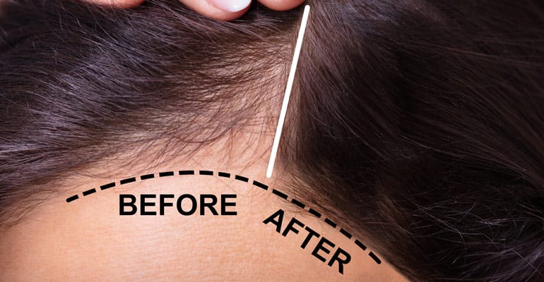Ava Laser Clinic By Anna