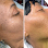 BodyKandie Beauty Spa