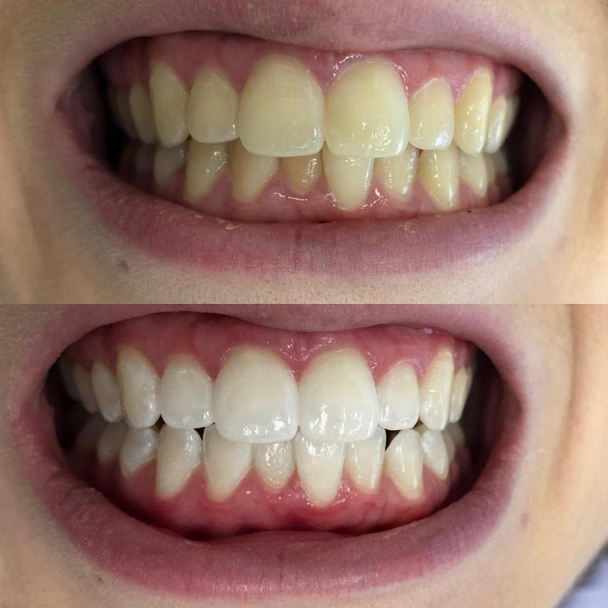 Baseline Village Dental Hygiene