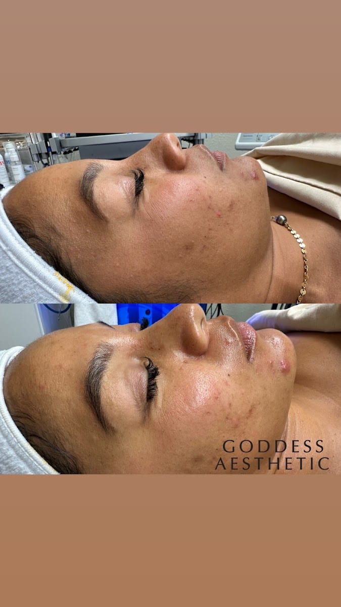 Goddess Aesthetic Med Spa & Wellness, photo 3