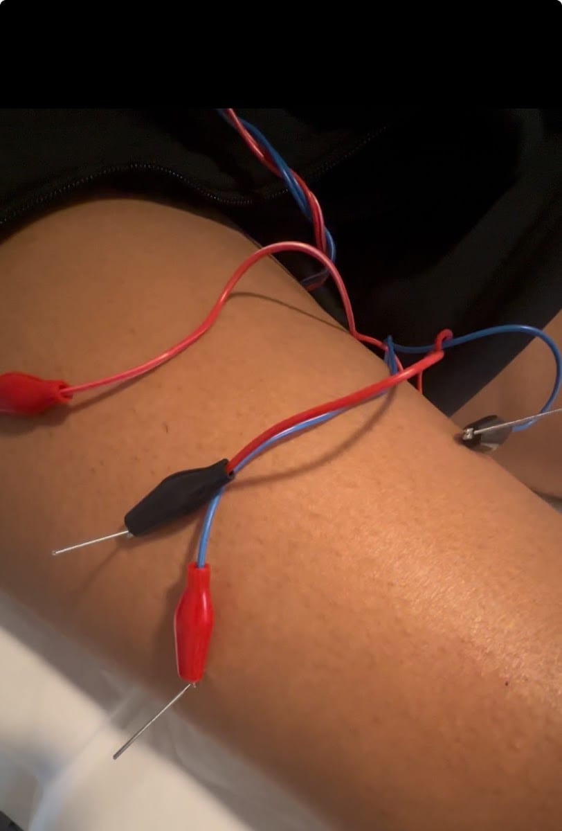 Dr. Divya- Physical Therapy & Performance Coaching, photo 3