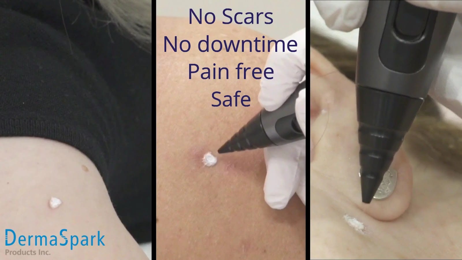 Lotus Laser Skin Rejuvenation, photo 3