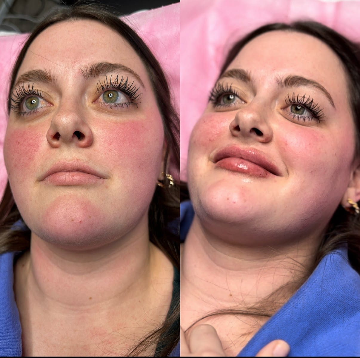 Texas Needle Queen • Botox & Lip Filler Clinic | Round Rock, TX, photo 4