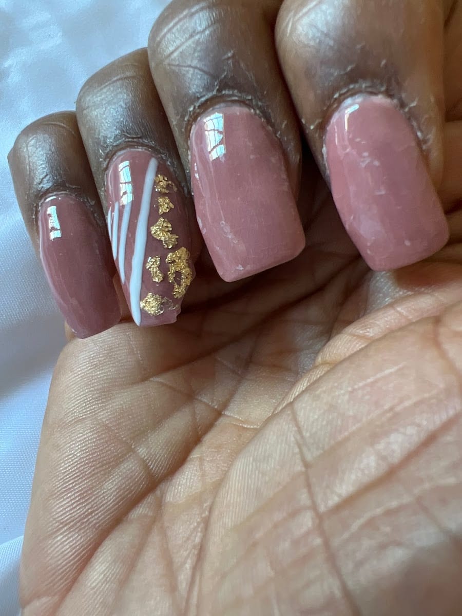 Nail Fever